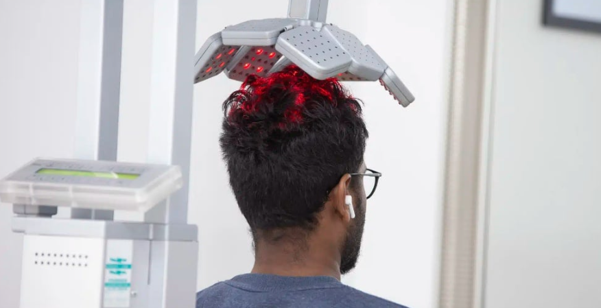 红光联合疗法治疗女性脱发见效快一倍